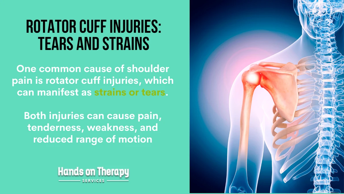 Rotator Cuff Tear Treatment – Surgery, Meds, Exercise, Cryosauna?