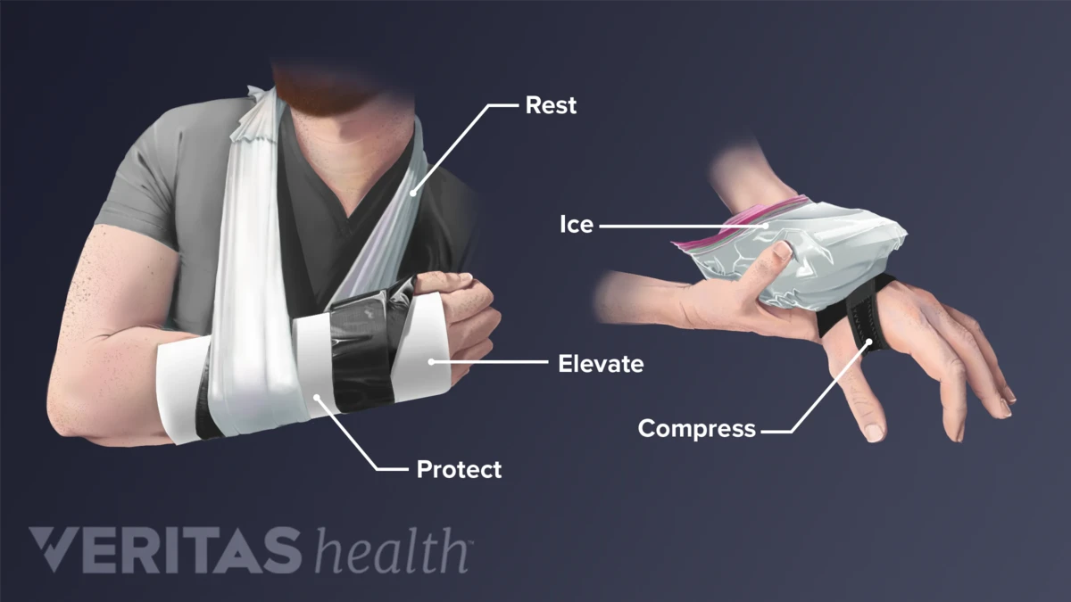 Raw Foods Linked to Pollen Allergy, Grass, Mugwort and Ragweed!